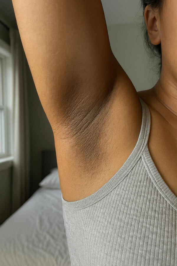 Before - Jessica L.