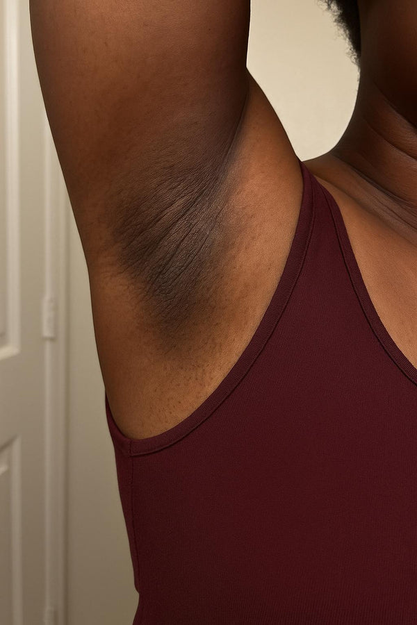Before - Amanda K.